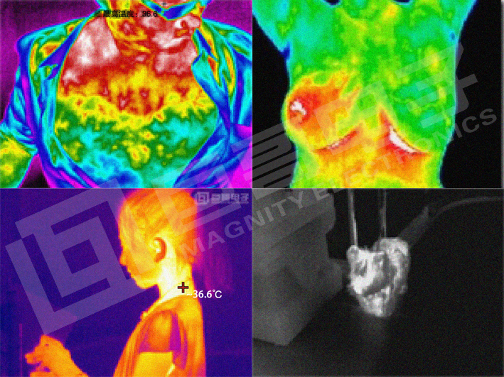 巨哥电子-手机热像仪检测体温